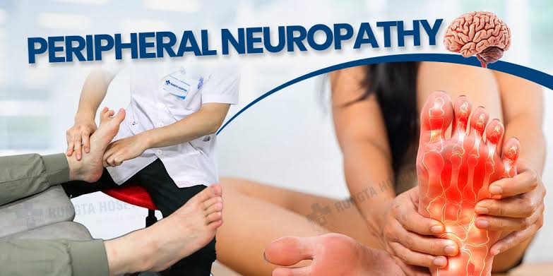 Peripheral Neuropathy